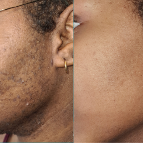 Nadia K., 34 ans - Zurich